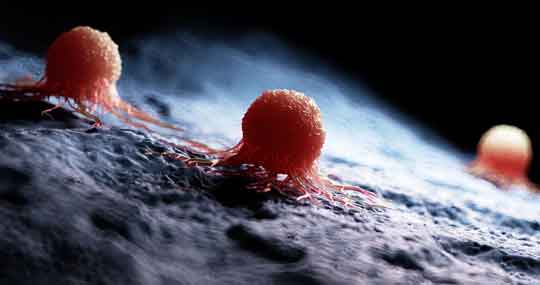 Oncology